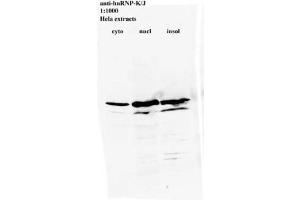 Image no. 2 for anti-Heterogeneous Nuclear Ribonucleoprotein K (HNRNPK) antibody (ABIN108575) (HNRNPK 抗体)