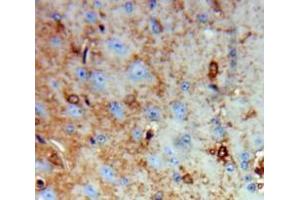 Used in DAB staining on fromalin fixed paraffin-embedded Brain tissue (Growth Hormone 1 抗体  (AA 28-217))