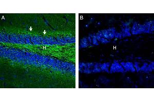 Expression of Neurofascin in mouse hippocampus. (NFASC 抗体  (C-Term, Intracellular))