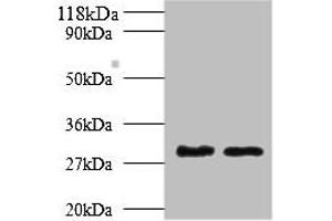 Western blot All lanes: Tpsb2 antibody at 2 μg/mL Lane 1: Mouse heart tissue Lane 2: Rat heart tissue Secondary Goat polyclonal to rabbit IgG at 1/10000 dilution Predicted band size: 31, 26 kDa Observed band size: 31 kDa (TPSB2 抗体  (AA 32-276))