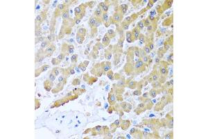 Immunohistochemistry of paraffin-embedded human liver using CCL8 antibody (ABIN5975074) at dilution of 1/100 (40x lens). (CCL8 抗体)