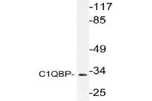 Western blot (WB) analysis of C1QBP antibody in extracts from Jurkat cells. (C1QBP 抗体)