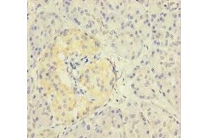 Immunohistochemistry of paraffin-embedded human pancreatic tissue using ABIN7176105 at dilution of 1:100 (ZNF114 抗体  (AA 1-414))
