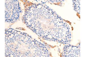 ABIN6267253 at 1/100 staining mouse testicular tissue sections by IHC-P. (CHEK2 抗体  (pThr68))