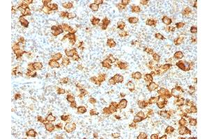 Immunohistochemistry (IHC) image for anti-Tumor Necrosis Factor Receptor Superfamily, Member 8 (TNFRSF8) antibody (ABIN6941151)