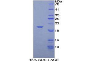 SDS-PAGE analysis of Rat Elongin A Protein. (TCEB3 蛋白)