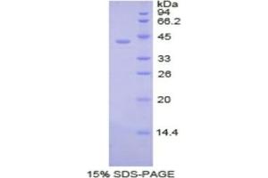 SDS-PAGE analysis of Human PDHa Protein. (PDHa 蛋白)