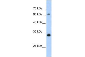 WB Suggested Anti-PCNA Antibody Titration:  1. (PCNA 抗体  (C-Term))