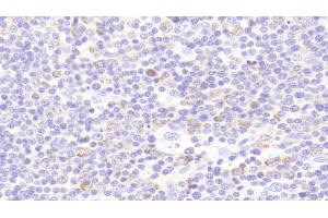 Immunohistochemistry (IHC) image for anti-Protein Kinase, AMP-Activated, beta 1 Non-Catalytic Subunit (PRKAB1) (AA 13-242) antibody (ABIN7433912)