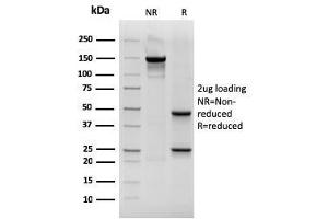SDS-PAGE Analysis Purified CK19 Mouse Recombinant Monoclonal Antibody (rKRT19/800). (Recombinant Cytokeratin 19 抗体)
