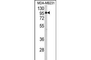 BAHD1 抗体  (C-Term)