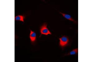 Immunofluorescent analysis of DFF45 staining in HeLa cells.