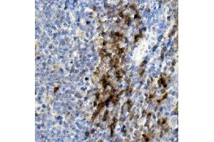 IHC analysis of CD8 alpha/Cd8a using anti-CD8 alpha/Cd8a antibody (ABIN7601570). (CD8 alpha 抗体  (AA 39-245))