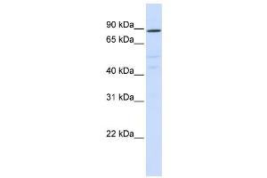 Western Blotting (WB) image for anti-ATPase, H+ Transporting, Lysosomal V0 Subunit A2 (ATP6V0A2) antibody (ABIN2458647)