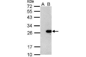 WB Image Sample (30 ug of whole cell lysate) A: Non-transfected 293T lysates B: BCL2 transfected 293T lysate 12% SDS PAGE antibody diluted at 1:5000 (Bcl-2 抗体)
