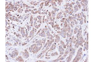 IHC-P Image Immunohistochemical analysis of paraffin-embedded MDA-MB-468 xenograft, using Cyclophilin A, antibody at 1:500 dilution. (PPIA 抗体  (C-Term))