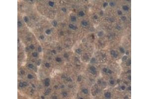 #VALUE! (LBP 抗体  (AA 27-481))