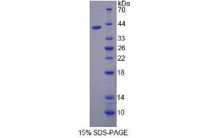 SDS-PAGE analysis of Mouse CAPN5 Protein. (Calpain 5 Protein (CAPN5))