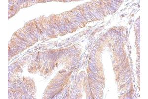 IHC-P Image ATP synthase B1 antibody detects ATP5F1 protein at cytosol on human colon by immunohistochemical analysis. (ATP Synthase B1 (Center) 抗体)