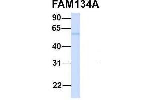 Host:  Rabbit  Target Name:  FAM134A  Sample Type:  Human Fetal Heart  Antibody Dilution:  1. (FAM134A 抗体  (N-Term))