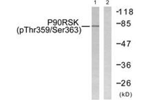 Western blot analysis of extracts from 293 cells treated with PMA 125ng/ml 30', using p90 RSK (Phospho-Thr359+Ser363) Antibody. (RPS6KA3 抗体  (pThr359))