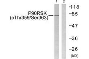 Western Blotting (WB) image for anti-Ribosomal Protein S6 Kinase, 90kDa, Polypeptide 3 (RPS6KA3) (AA 331-380), (pThr359) antibody (ABIN1531362)