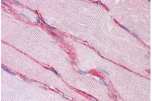 Human Skeletal Muscle: Formalin-Fixed, Paraffin-Embedded (FFPE) (SGCB 抗体  (AA 87-197))