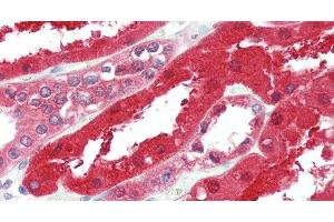 Immunohistochemistry of paraffin-embedded Kidney tissue using GPC6 Polyclonal Antibody at dilution of 1:90. (Glypican 6 抗体)