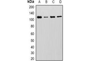 Western blot analysis of MCM6 expression in U251 (A), Hela (B), Jurkat (C), mouse spleen (D) whole cell lysates. (MCM6 抗体)