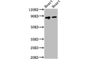 Western Blot Positive WB detected in: Rat heart tissue, Mouse heart tissue All lanes: ACO2 antibody at 2. (ACO2 抗体  (AA 452-676))