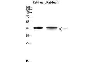 Western Blot (WB) analysis of Rat Heart and Rat Brain using Cerberus Polyclonal Antibody diluted at 1:500. (CER1 抗体  (Internal Region))