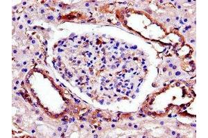 Immunohistochemistry of paraffin-embedded human kidney tissue using ABIN7173365 at dilution of 1:100 (TRIB3 抗体  (AA 152-325))