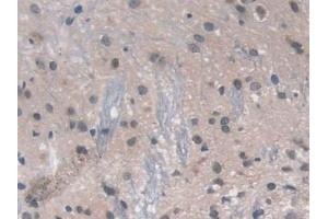 Immunohistochemistry (IHC) image for anti-Advanced Glycosylation End Product-Specific Receptor (AGER) (AA 1-237) antibody (ABIN7441463)