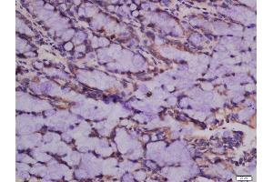 Formalin-fixed and paraffin embedded rat intestine labeled with Anti-ATG101 Polyclonal Antibody, Unconjugated  at 1:300 followed by conjugation to the secondary antibody and DAB staining. (ATG101 抗体  (AA 121-218))