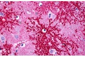 Anti-SLC1A2 / EAAT2 antibody IHC staining of human brain, astrocytes. (SLC1A2 抗体  (C-Term))