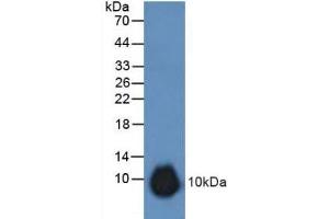 Detection of GREM1 in Rat Stomach Tissue using Polyclonal Antibody to Gremlin 1 (GREM1) (GREM1 抗体  (AA 25-184))