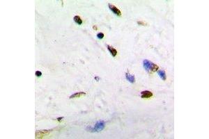 Immunohistochemical analysis of ADNP staining in human brain formalin fixed paraffin embedded tissue section.