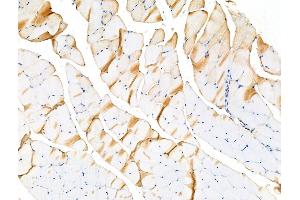 ABIN6264099 and ABIN6266621 at 1/100 staining Rat muscle tissue by IHC-P.