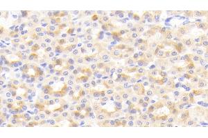 Detection of CIDEC in Rat Stomach Tissue using Polyclonal Antibody to Cell Death Inducing DFFA Like Effector C (CIDEC) (CIDEC 抗体  (AA 1-221))