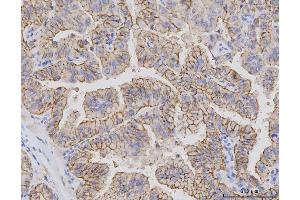 IHC analysis of Claudin 3/CLDN3 using anti-Claudin 3/CLDN3 antibody (ABIN7599625).
