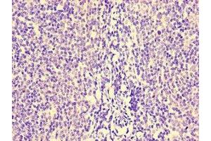 Immunohistochemistry of paraffin-embedded human lymph node tissue using ABIN7155534 at dilution of 1:100 (HCP5 抗体  (AA 8-101))