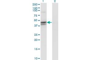 Western Blotting (WB) image for anti-Calcium Activated Nucleotidase 1 (CANT1) (AA 302-401) antibody (ABIN961190) (CANT1 抗体  (AA 302-401))