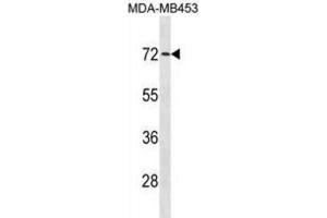 Western Blotting (WB) image for anti-Mex-3 Homolog C (C. Elegans) (MEX3C) antibody (ABIN3001399) (MEX3C 抗体)