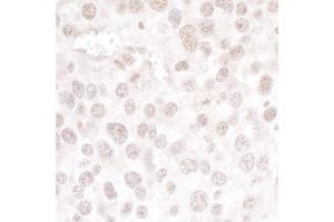 Immunohistochemistry (IHC) image for anti-hPrp3p (AA 100-150) antibody (ABIN7453461) (hPrp3p (AA 100-150) 抗体)