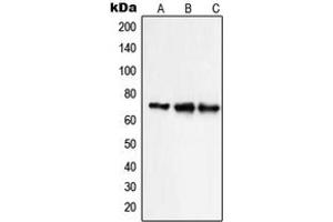 Western blot analysis of NHE9 expression in HepG2 (A), Caco2 HeLa (B), NIH3T3 (C) whole cell lysates. (SLC9A9 抗体  (Center))