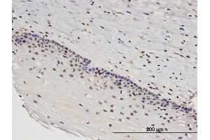 Immunoperoxidase of monoclonal antibody to RTKN2 on formalin-fixed paraffin-embedded human uterine cervix. (RTKN2 抗体  (AA 1-163))