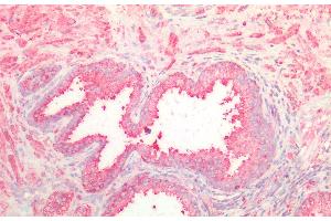 Detection of NOTCH2NL in Human Prostate Tissue using Polyclonal Antibody to Notch2 N-Terminal Like Protein (NOTCH2NL) (NOTCH2NL 抗体  (AA 1-236))