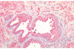 Detection of NOTCH2NL in Human Prostate Tissue using Polyclonal Antibody to Notch2 N-Terminal Like Protein (NOTCH2NL) (NOTCH2NL 抗体  (AA 1-236))