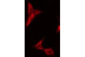 ABIN6275571 staining HeLa by IF/ICC. (SIRPB1 抗体)