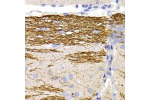 Immunohistochemistry of paraffin-embedded rat brain using NEFL antibody.